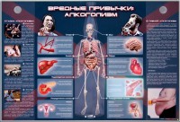 Электрифицированный стенд "Вредные привычки: алкоголизм" - fgospostavki.ru - Выкса