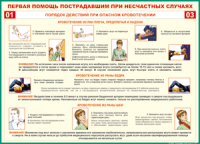 Таблица "Порядок действий при опасном кровотечении" (100х140 сантиметров, винил) - fgospostavki.ru - Выкса