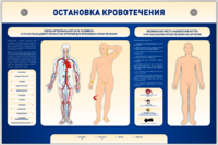 Электрифицированный стенд-тренажер "Остановка кровотечения" - fgospostavki.ru - Выкса